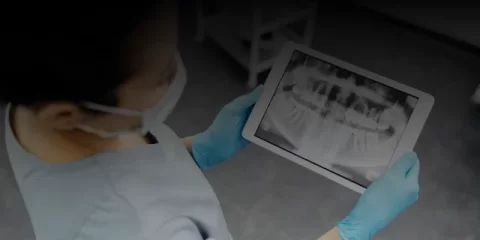 За выходные дорожники Ульяновска отремонтировали 950 квадратных метров покрытия горячим асфальтом