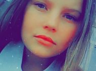 Пропала 12-летняя девочка со шрамом на лбу
