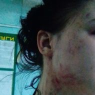 Анестезиолог ЦКГБ избил пациента после операции? В Ульяновске проводится проверка